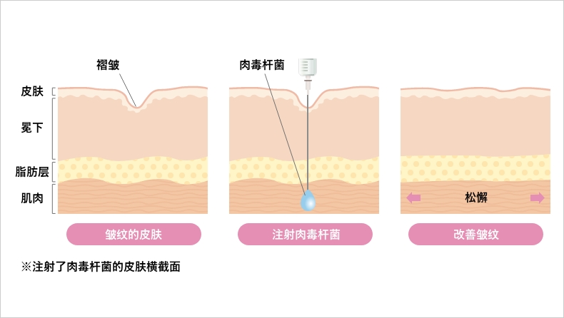 しわ改善だけではなく皮脂抑制などの効果も