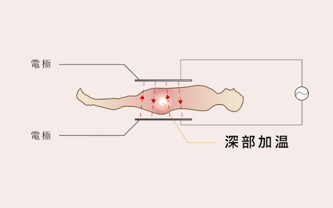 インディバボディの特徴