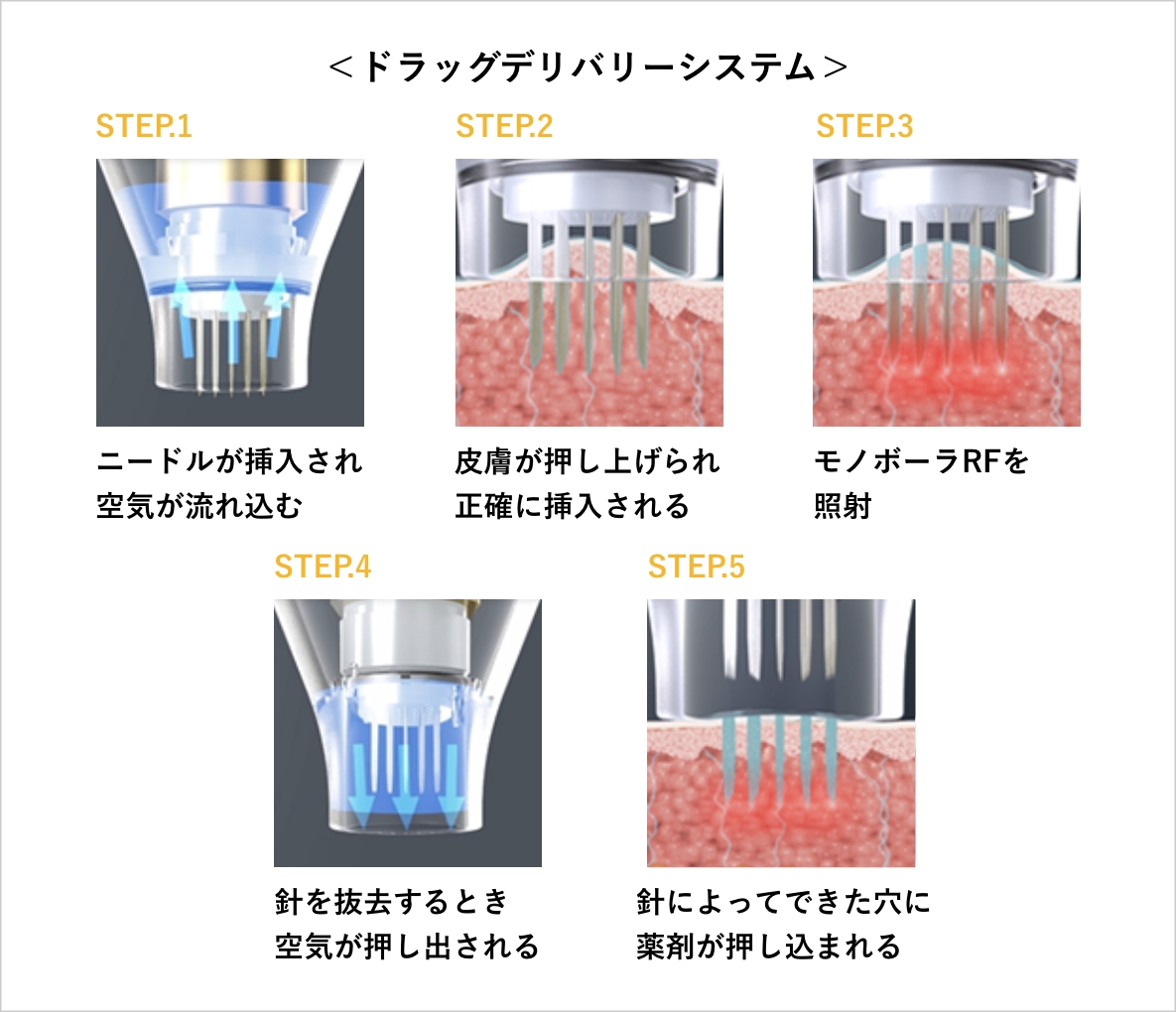 ドラッグデリバリーシステム