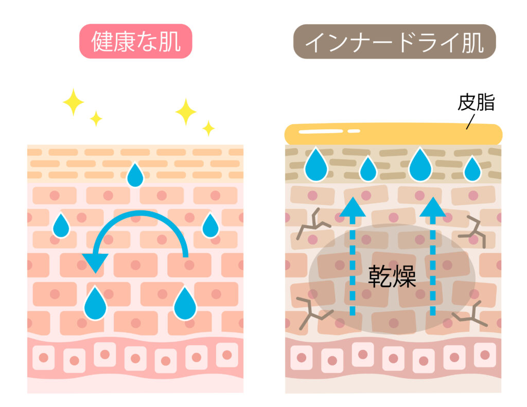 それは何ですか？