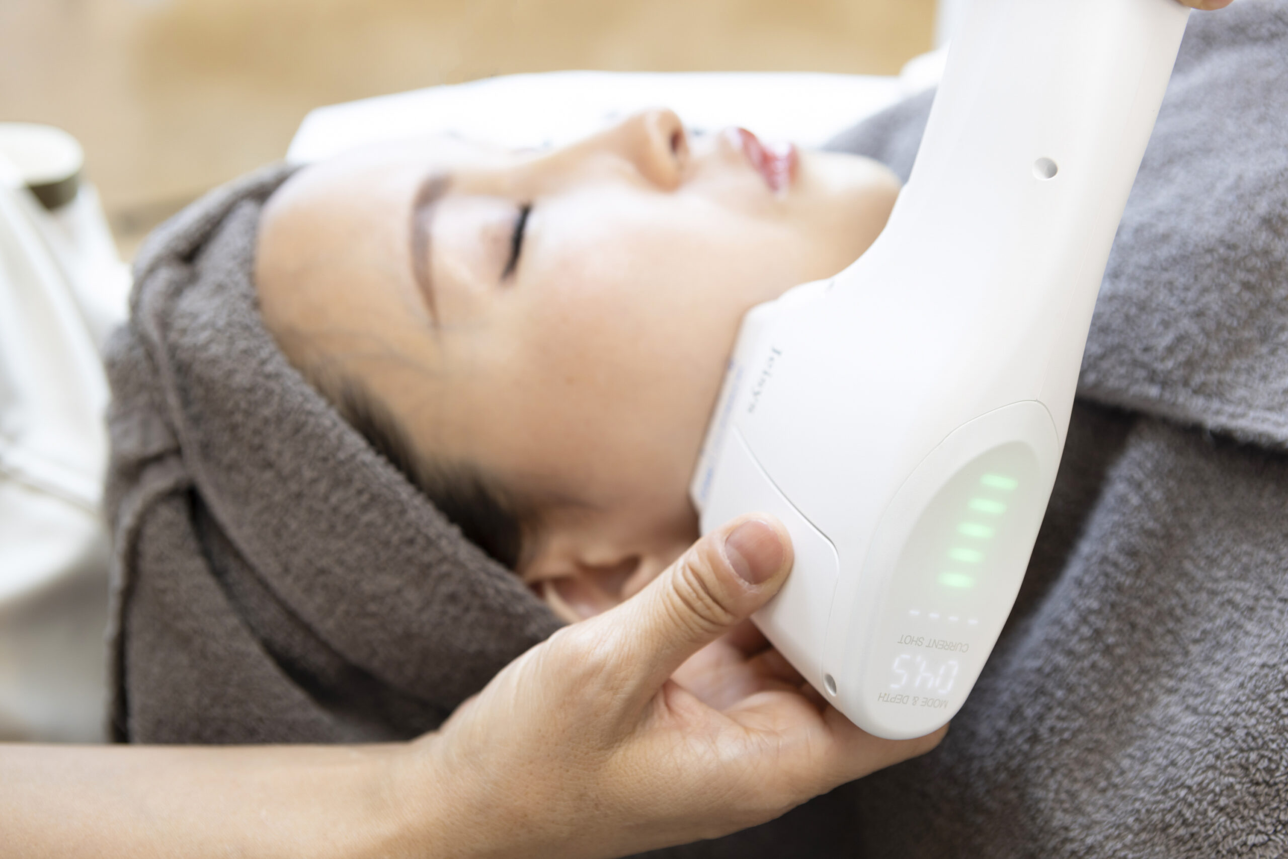 ウルトラセル[Zi]・ウルトラセルQ＋ってどんなマシン？他のHIFU機器との違いは？