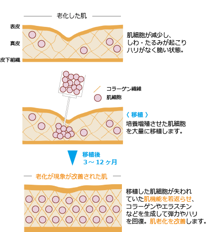 肌の老化