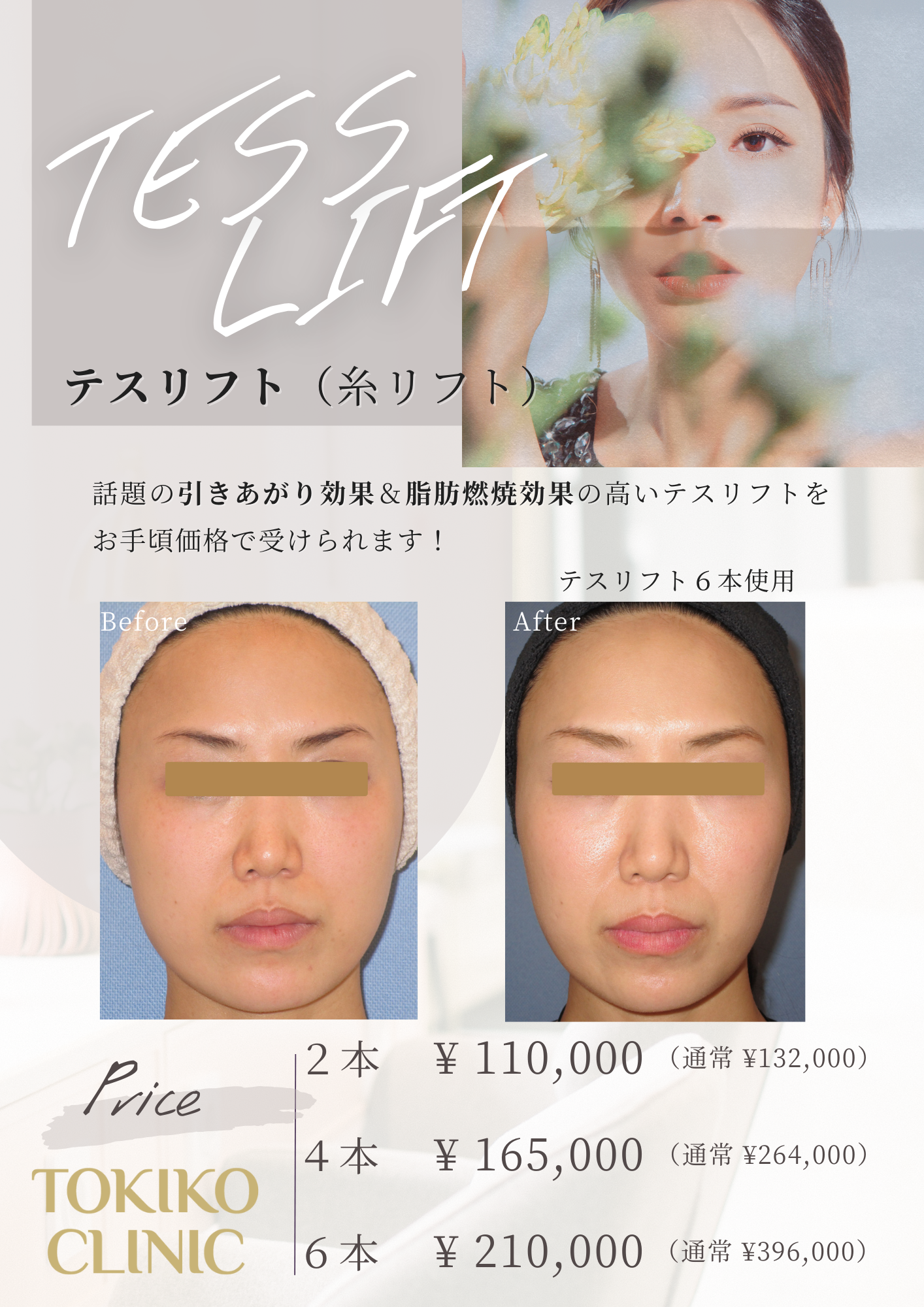 テスリフト