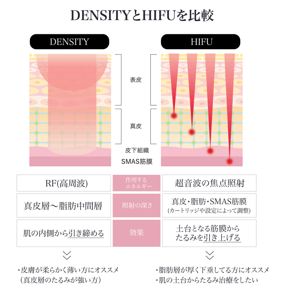 DENSITYとHIFUの比較図: DENSITYは高周波RFを使用し真皮層から脂肪中間層を引き締める施術で、皮膚が薄い方におすすめ。HIFUは超音波の焦点照射を使用し真皮・脂肪・SMAS筋膜を土台から引き上げ、脂肪が厚いたるみを持つ方におすすめ。