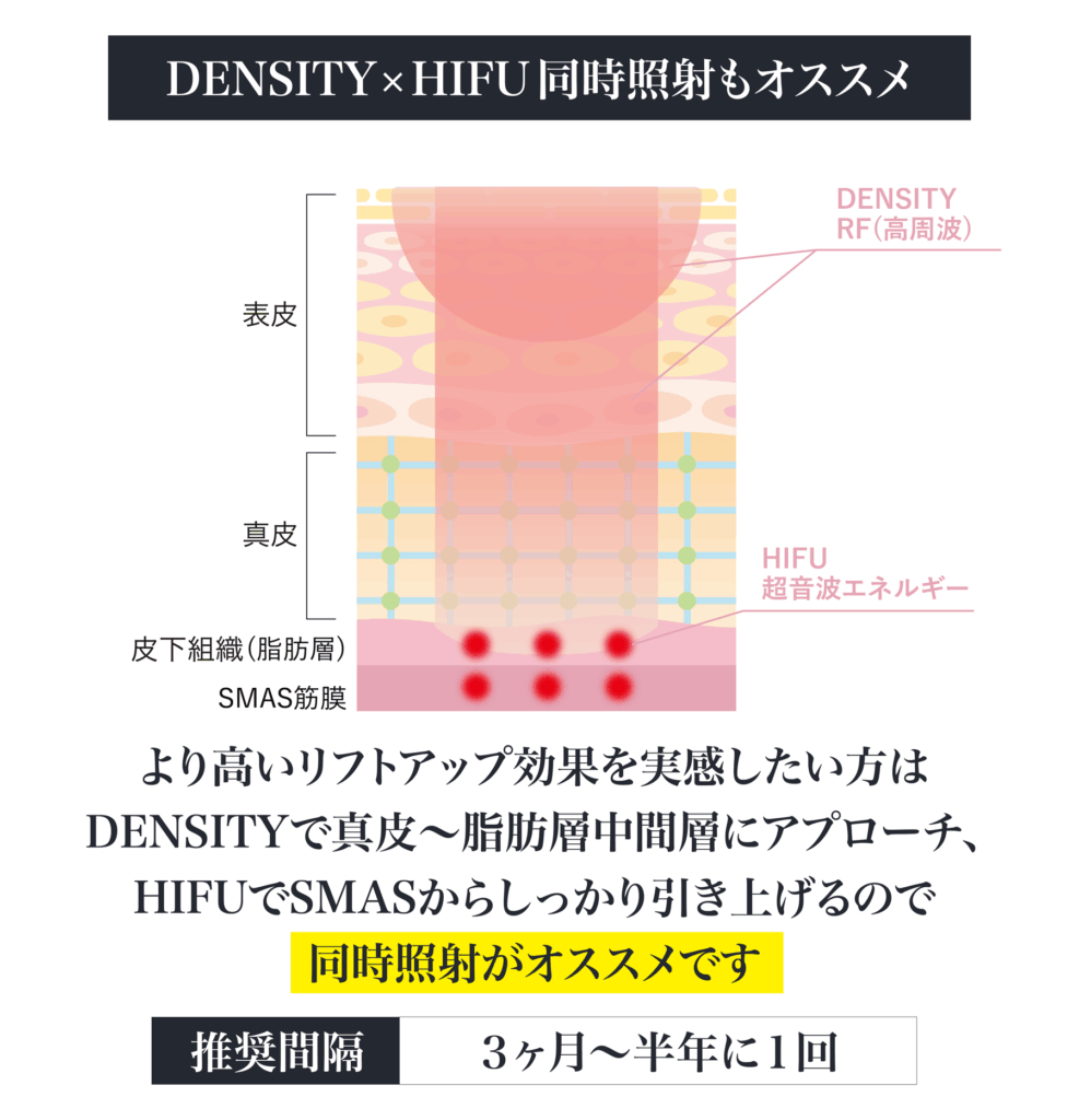 DENSITYとHIFU同時照射の推奨図解: DENSITY（RF高周波）で真皮から脂肪層中間層にアプローチし、HIFU（超音波エネルギー）でSMAS筋膜からしっかり引き上げ、より高いリフトアップ効果を得るために同時照射を推奨。推奨間隔は3ヶ月〜半年に1回。